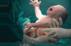 تلف شدن دو نوزاد در بیمارستان شهید نورانی تالش !