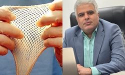 عمل جراحی پیوند پوست مصنوعی توسط دکتر صفار در بیمارستان شهید نورانی تالش